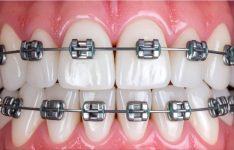 Ortho correction