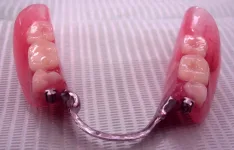 Precession Attachments